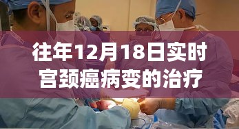 探秘小巷深處的宮頸癌病變治療秘境，生命重塑的奇跡之旅在每年的12月18日開(kāi)啟