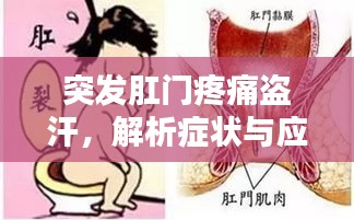 突發(fā)肛門疼痛盜汗，解析癥狀與應(yīng)對良方