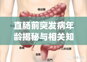 直腸前突發(fā)病年齡揭秘與相關知識深度解析