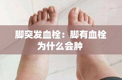 腳突發(fā)血栓：腳有血栓為什么會腫 