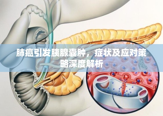 肺癌引發(fā)胰腺囊腫，癥狀及應(yīng)對(duì)策略深度解析