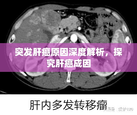 突發(fā)肝癌原因深度解析，探究肝癌成因