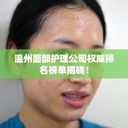 溫州面部護理公司權(quán)威排名榜單揭曉！