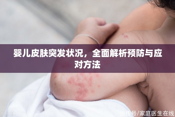 嬰兒皮膚突發(fā)狀況，全面解析預(yù)防與應(yīng)對(duì)方法