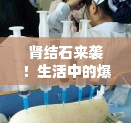 腎結(jié)石來(lái)襲！生活中的爆笑瞬間一網(wǎng)打盡！