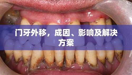 門(mén)牙外移，成因、影響及解決方案