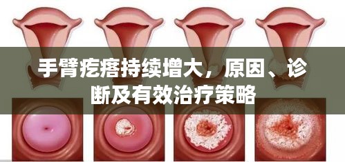 手臂疙瘩持續(xù)增大，原因、診斷及有效治療策略