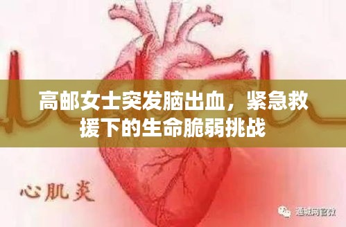 高郵女士突發(fā)腦出血，緊急救援下的生命脆弱挑戰(zhàn)