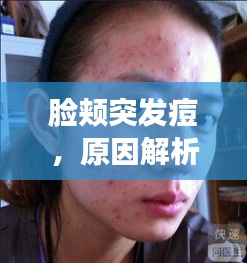 臉頰突發(fā)痘，原因解析、預(yù)防策略及應(yīng)對妙招