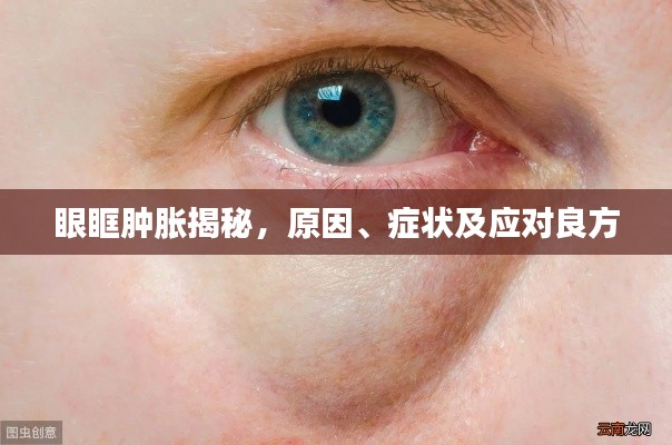 眼眶腫脹揭秘，原因、癥狀及應對良方