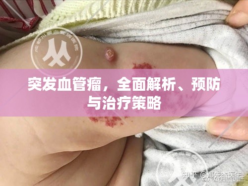 突發(fā)血管瘤，全面解析、預(yù)防與治療策略