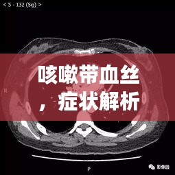 咳嗽帶血絲，癥狀解析、誘因探究及有效治療策略